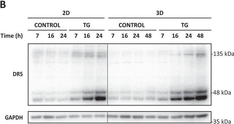 Detection of TRAIL R2/TNFRSF10B by Western Blot