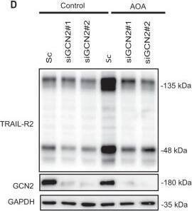 Detection of Human TRAIL R2/TNFRSF10B by Western Blot