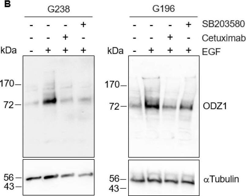 Detection of Teneurin-1 by Western Blot