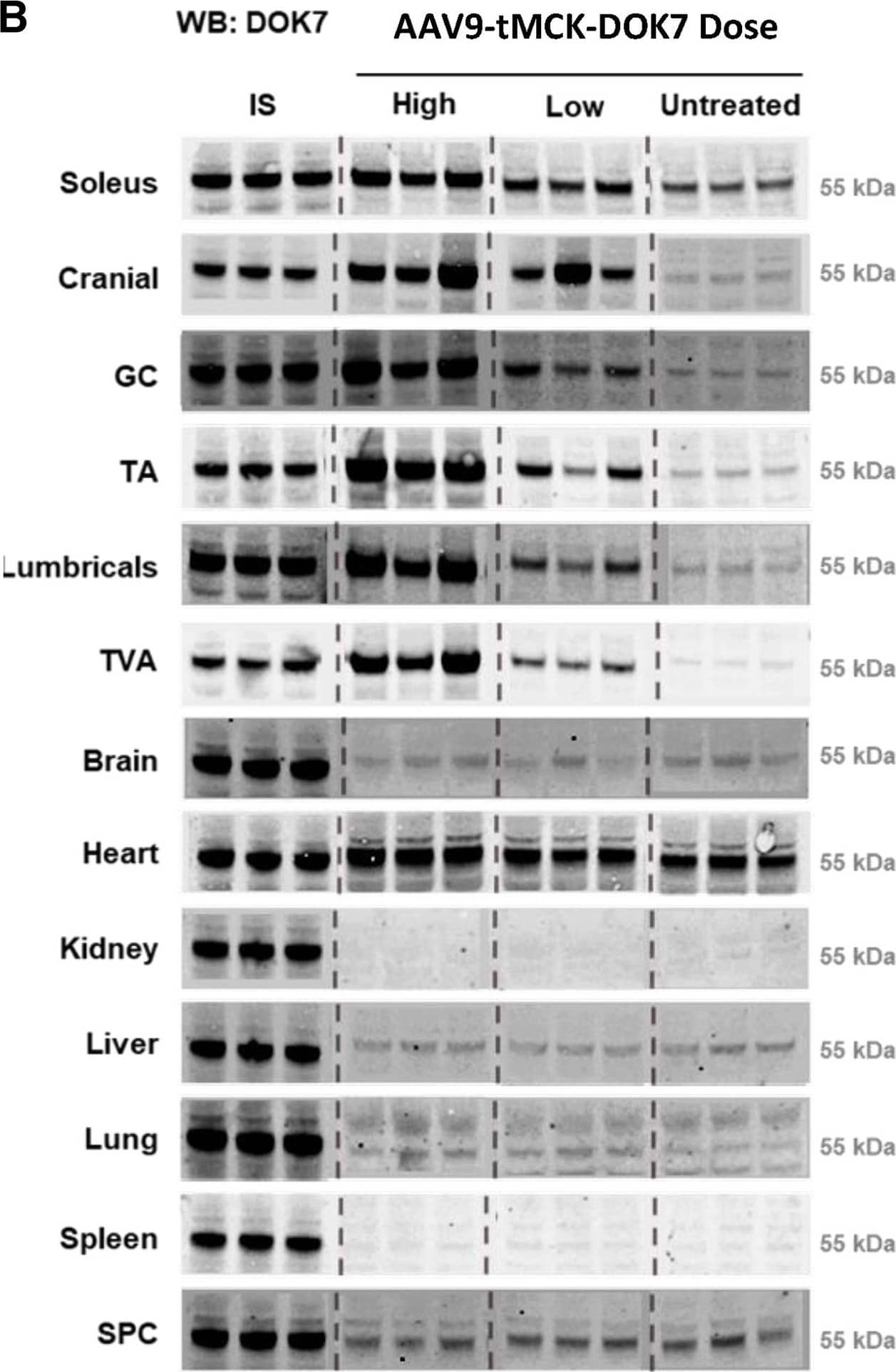 Detection of DOK7 by Western Blot