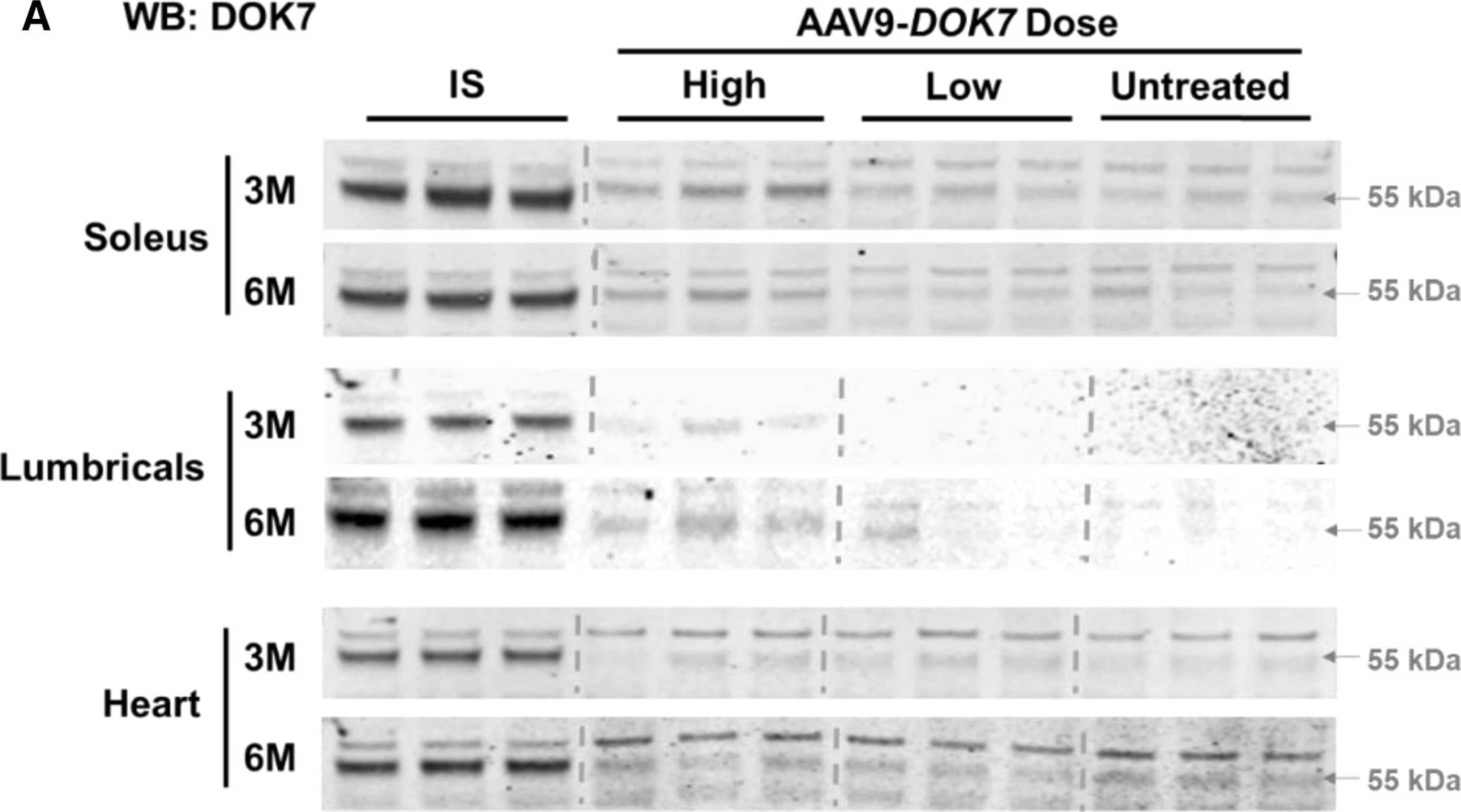 Detection of DOK7 by Western Blot
