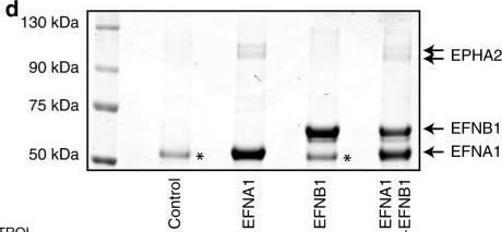 Detection of EphA2 by Western Blot