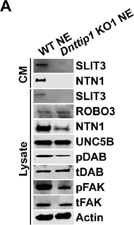 Detection of Mouse Netrin-1 by Western Blot