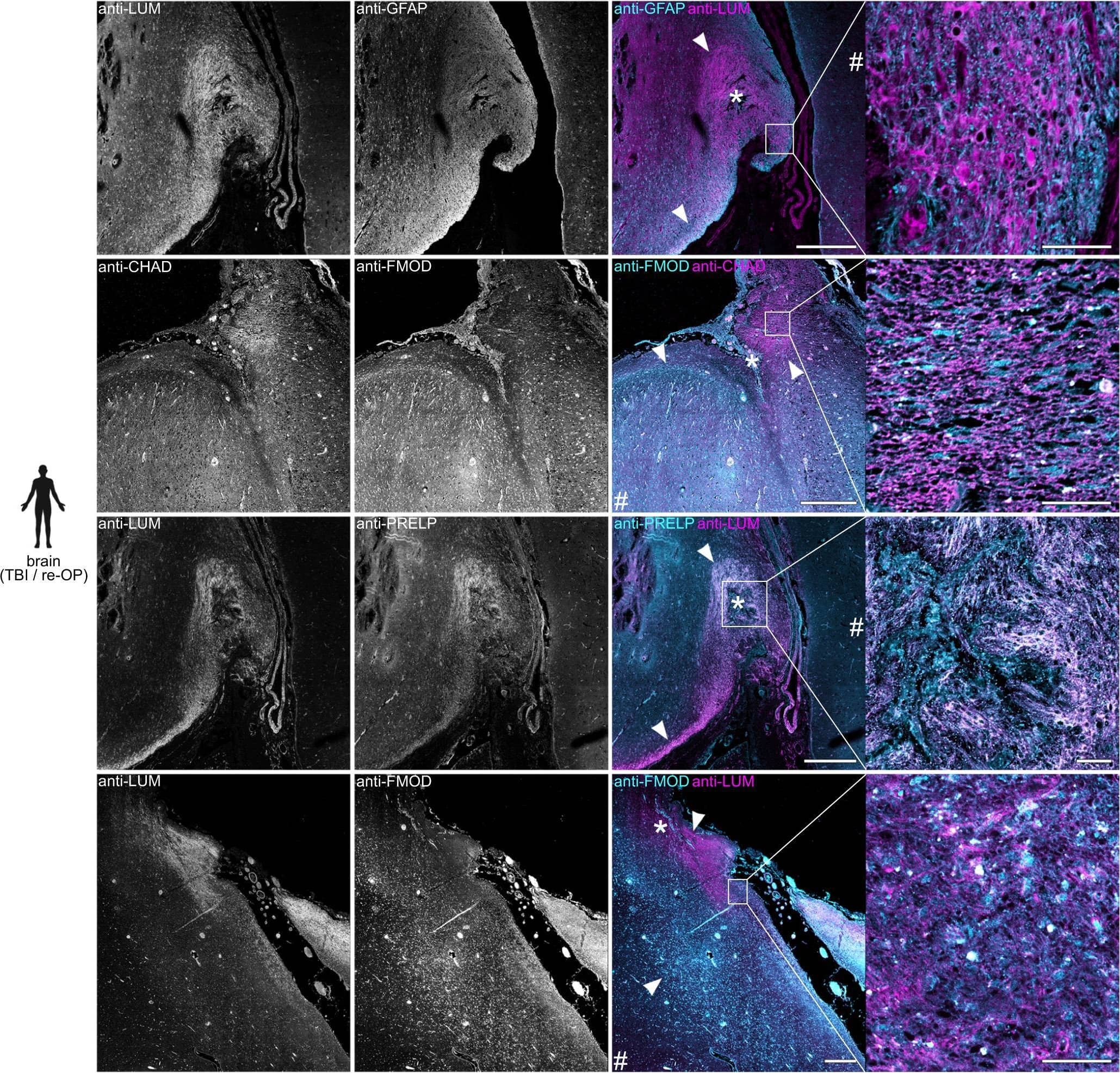 Detection of Zebrafish PRELP by Immunohistochemistry
