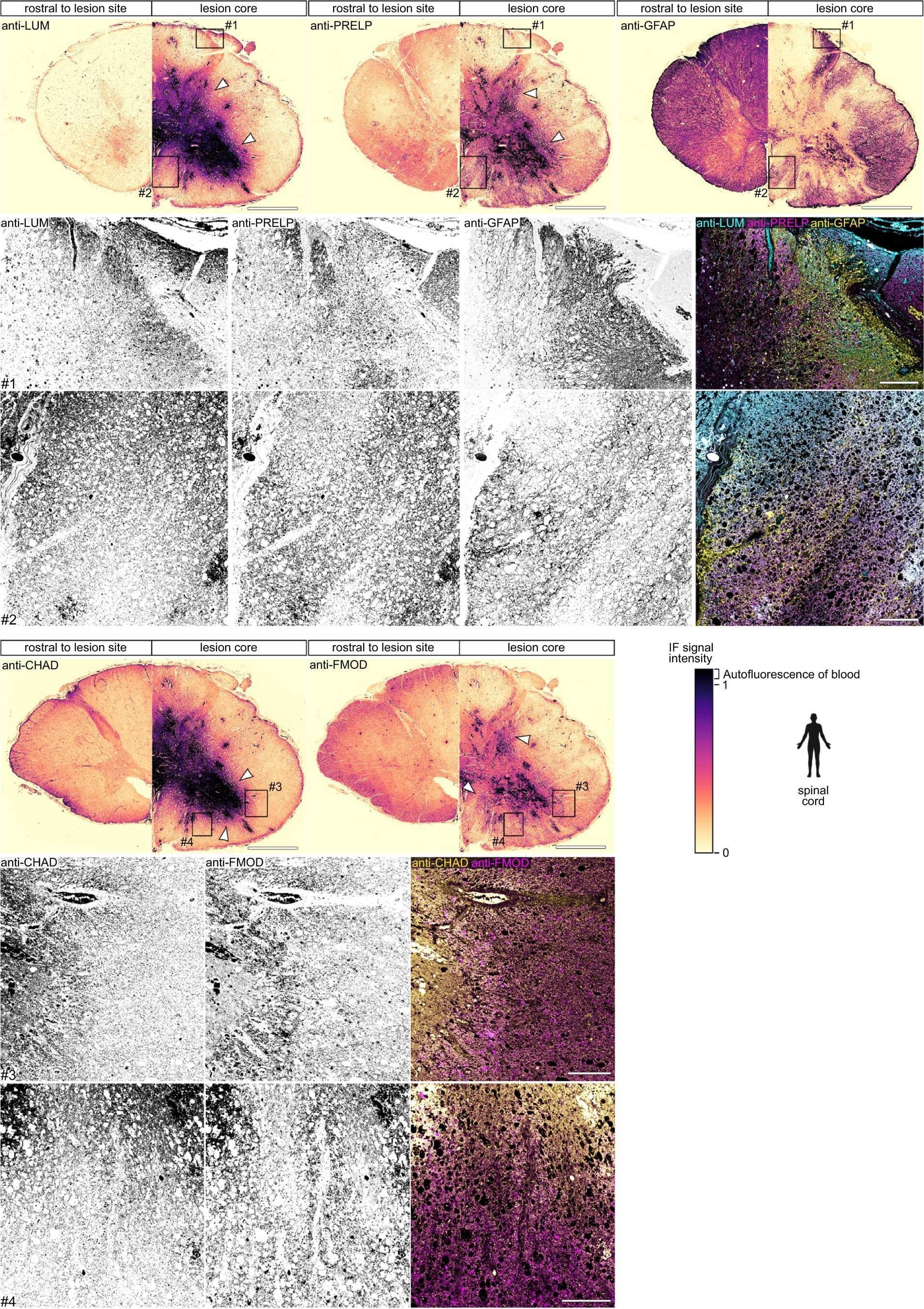 Detection of Zebrafish PRELP by Immunohistochemistry