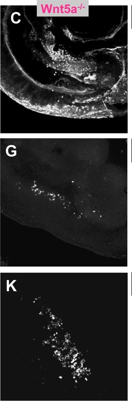 Detection of Mouse Wnt-5a by Immunohistochemistry
