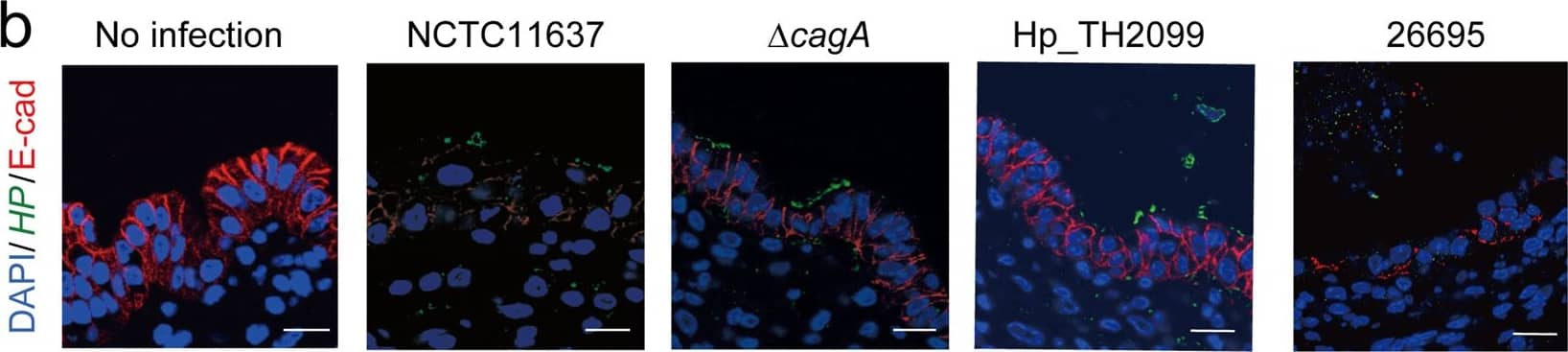 Detection of Human E-Cadherin by Immunocytochemistry/Immunofluorescence Detection of Human E-Cadherin by Immunocytochemistry/Immunofluorescence