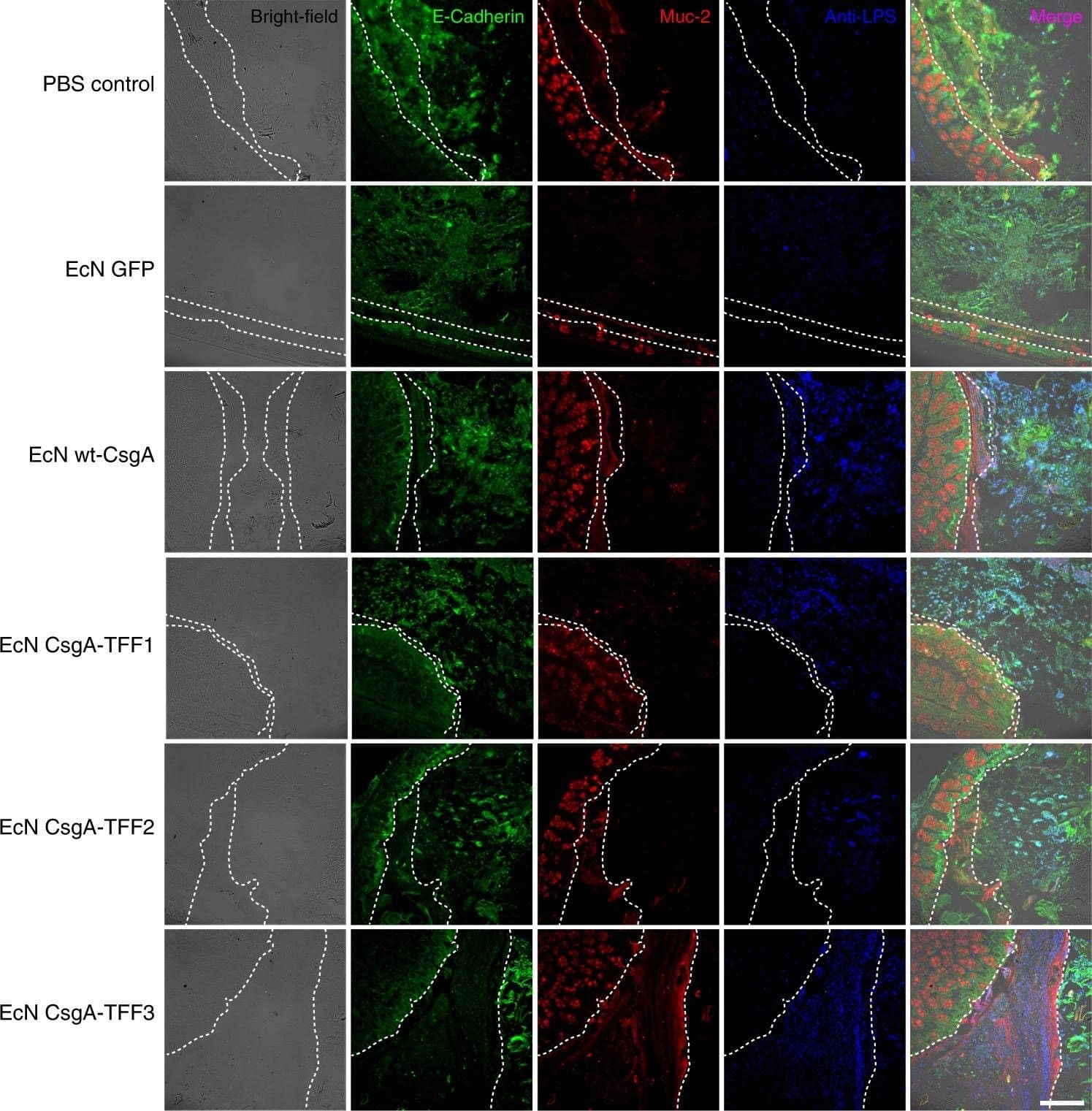 Detection of Mouse E-Cadherin by Immunohistochemistry Detection of Mouse E-Cadherin by Immunohistochemistry