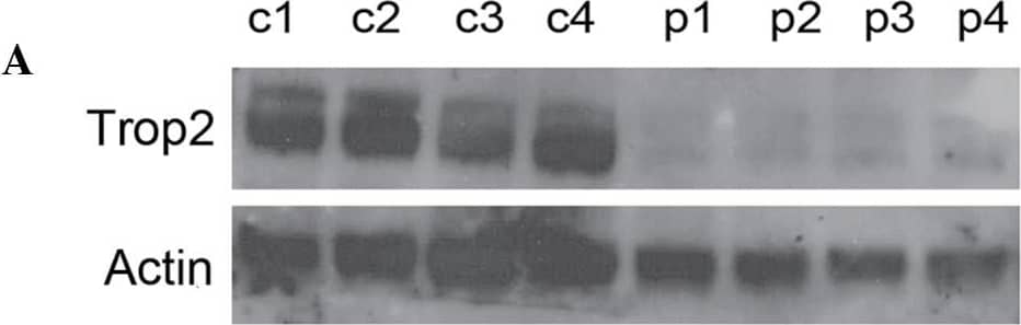 Detection of Human TROP-2 by Western Blot