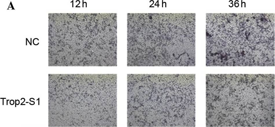 Detection of Human TROP-2 by Immunohistochemistry