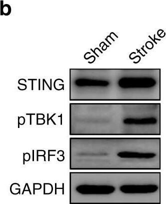Detection of Mouse Human STING/TMEM173 Antibody by Western Blot