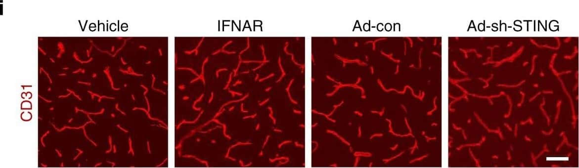 Detection of Mouse Human STING/TMEM173 Antibody by Immunohistochemistry