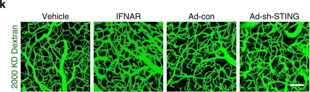Detection of Mouse Human STING/TMEM173 Antibody by Immunohistochemistry