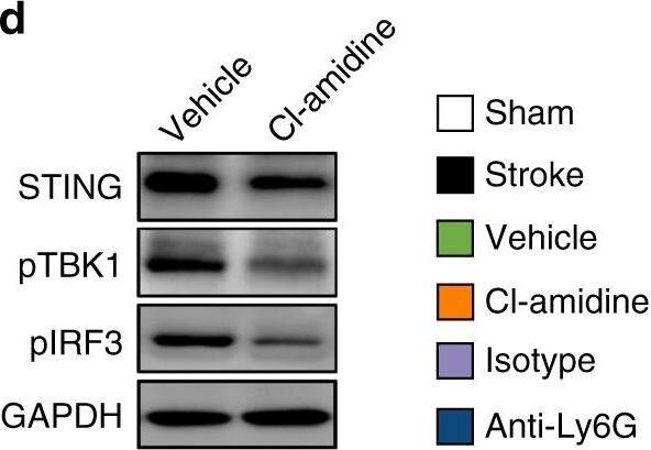 Detection of Mouse Human STING/TMEM173 Antibody by Western Blot