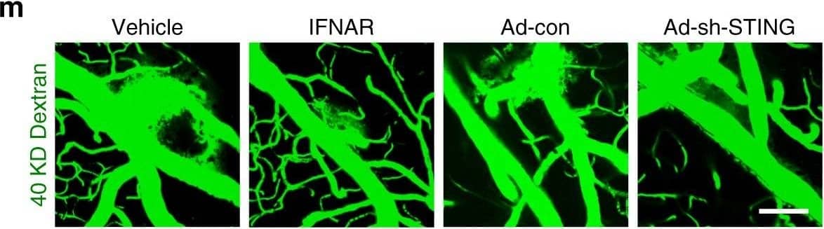 Detection of Mouse Human STING/TMEM173 Antibody by Immunohistochemistry
