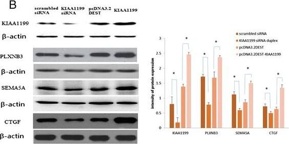 Detection of Human CTGF/CCN2 by Western Blot