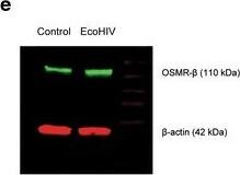 Detection of Mouse OSMR beta by Western Blot