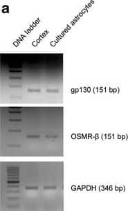 Detection of Mouse OSMR beta by Western Blot
