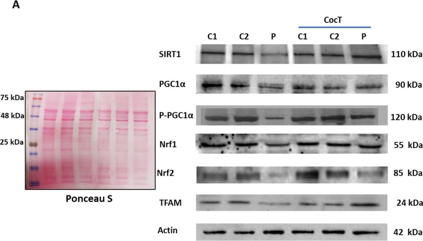 Detection of Phospho-PGC1 alpha (S571) by Western Blot