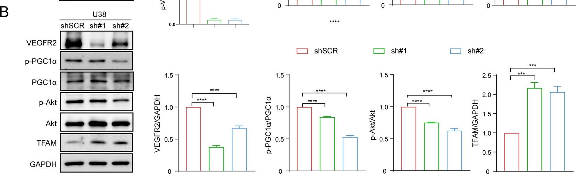 Detection of Phospho-PGC1 alpha (S571) by Western Blot