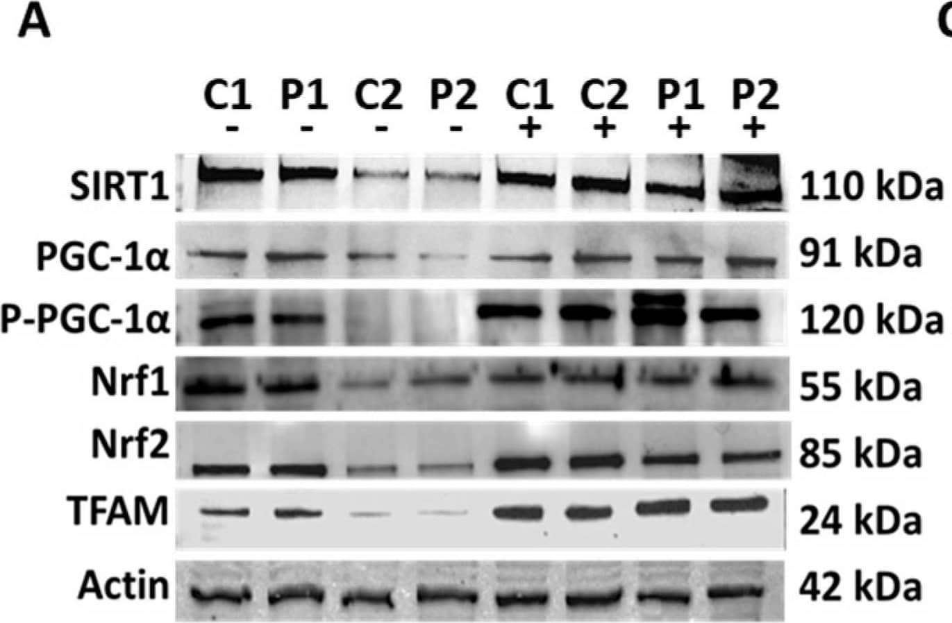 Detection of Phospho-PGC1 alpha (S571) by Western Blot