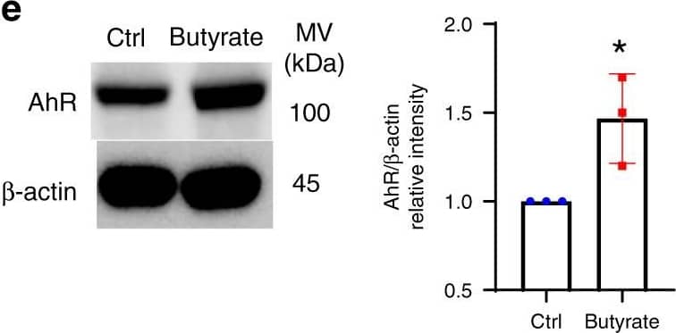 Detection of Mouse AHR by Western Blot