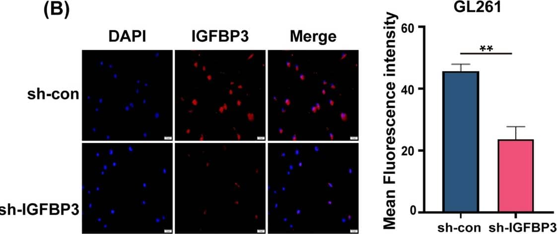 Detection of IGFBP-3 by Immunocytochemistry/ Immunofluorescence