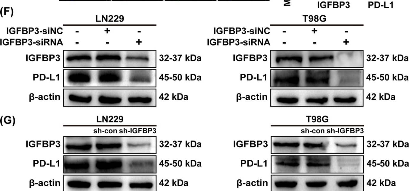 Detection of IGFBP-3 by Western Blot