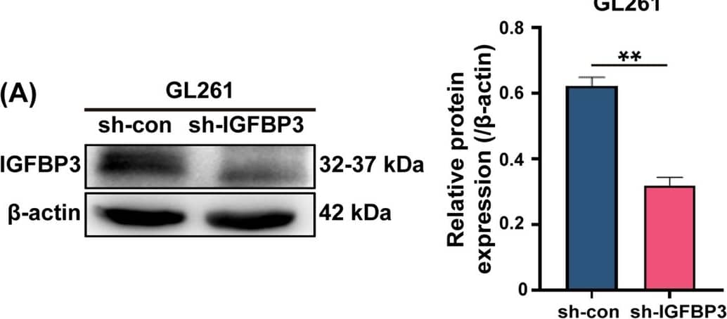 Detection of IGFBP-3 by Western Blot