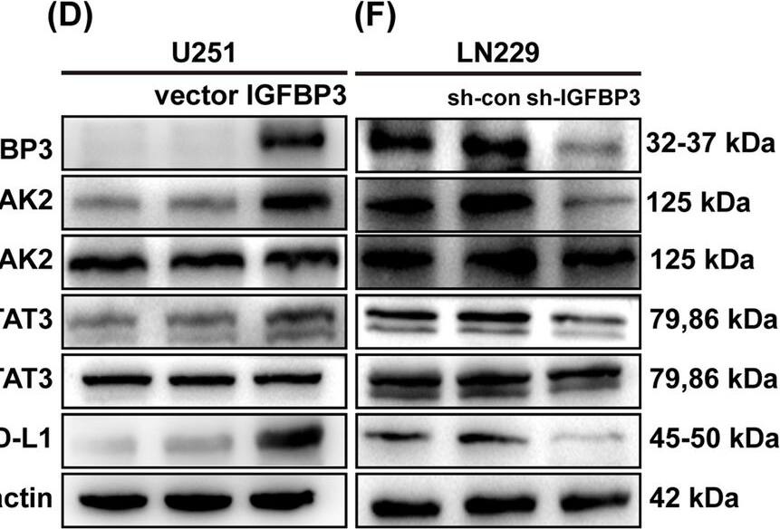 Detection of IGFBP-3 by Western Blot