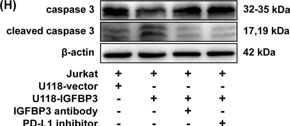 Detection of IGFBP-3 by Western Blot
