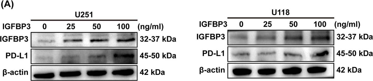 Detection of IGFBP-3 by Western Blot