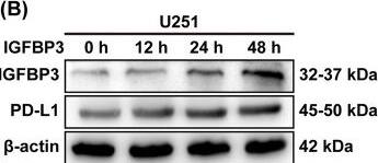 Detection of IGFBP-3 by Western Blot