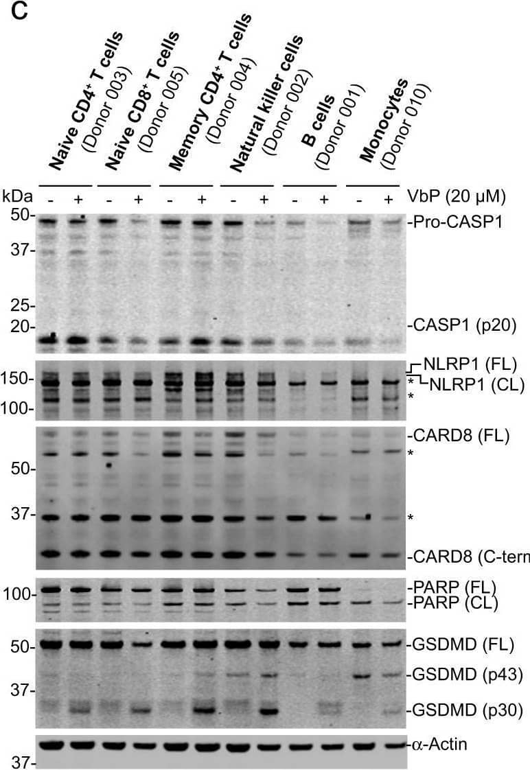 Detection of NLRP1/NALP1 by Western Blot