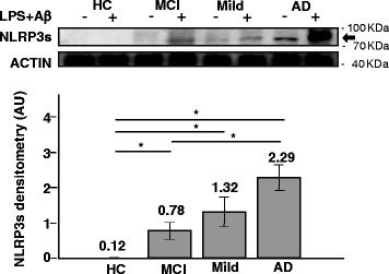 Detection of Human NLRP3/NALP3 by Western Blot