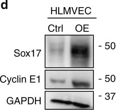 Detection of Mouse Cyclin E1 by Western Blot