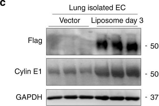 Detection of Mouse Cyclin E1 by Western Blot