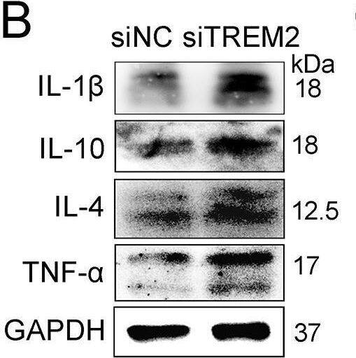 Detection of Porcine IL-1 beta/IL-1F2 by Western Blot