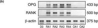 Detection of Human RANK/TNFRSF11A by Western Blot