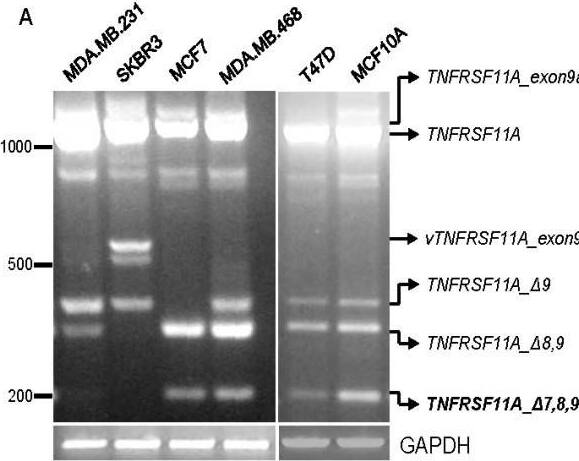 Detection of RANK/TNFRSF11A by Western Blot