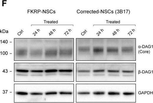 Detection of Human Dystroglycan by Western Blot