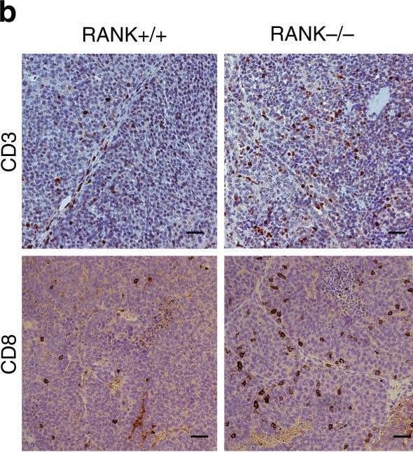 Detection of RANK/TNFRSF11A by Immunohistochemistry
