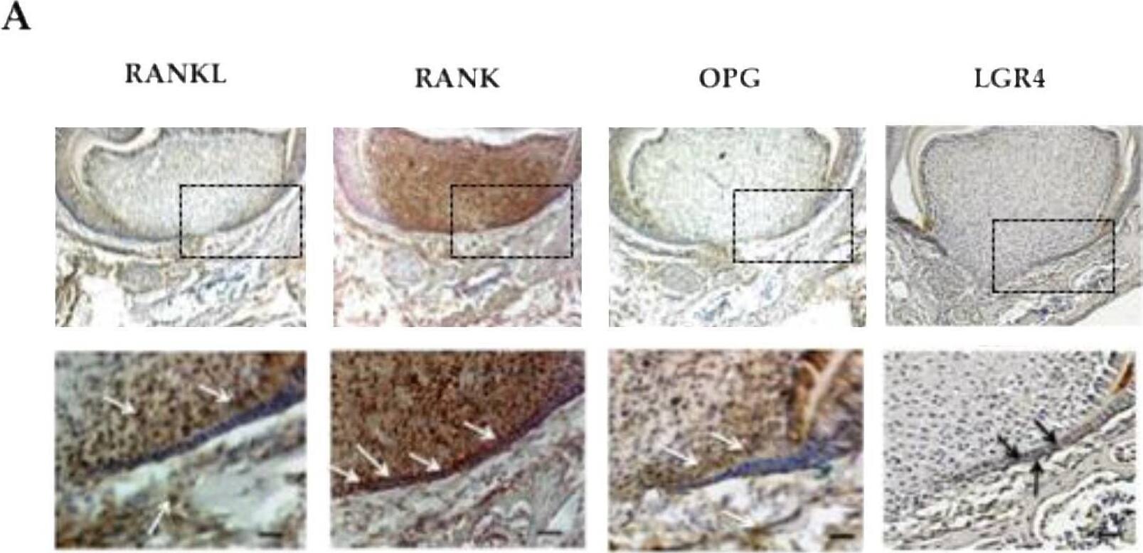 Detection of Mouse RANK/TNFRSF11A by Immunohistochemistry