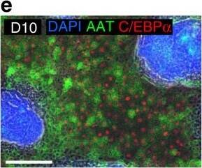 Detection of Human CEBP alpha by Immunocytochemistry/Immunofluorescence