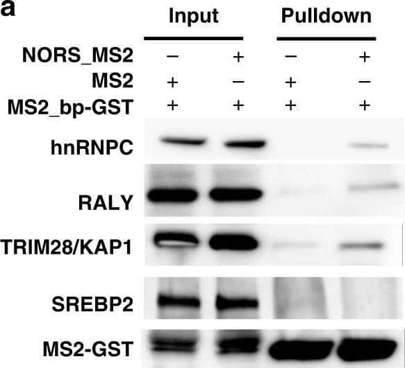 Detection of Human SREBP2 by Western Blot
