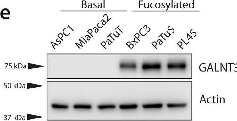 Detection of Human Polypeptide GalNAc Transferase 3/GALNT3 by Western Blot