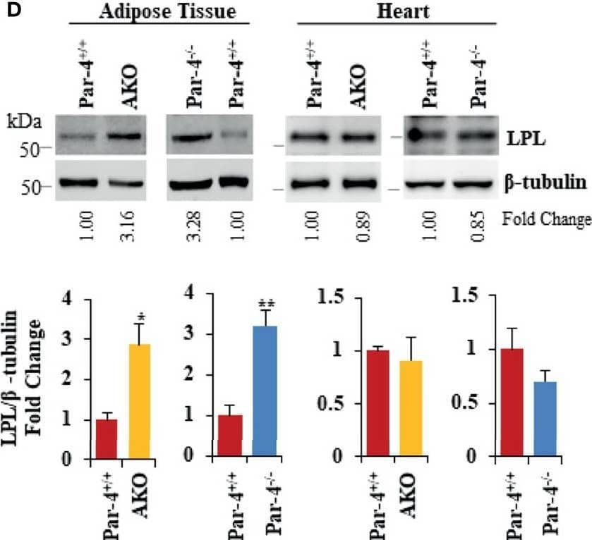 Detection of Lipoprotein Lipase/LPL by Western Blot