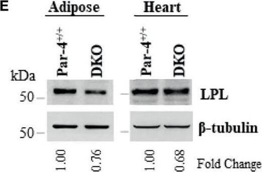 Detection of Lipoprotein Lipase/LPL by Western Blot
