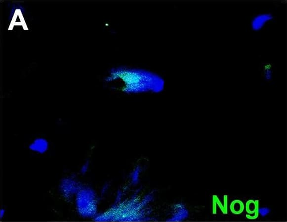 Detection of Human Noggin by Immunohistochemistry
