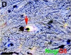 Detection of Human Noggin by Immunohistochemistry